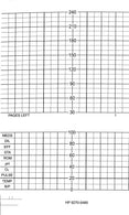 Graphic Controls Medical Chart Recording HP Fetal ECG Paper Roll, 151 mm x 50' - 7G10643709 - 40 Each