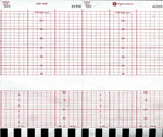 Graphic Controls Medical Chart Recording Papers 7G30597226 - 1.0 Each