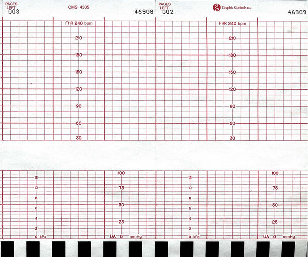 Graphic Controls Medical Chart Recording Papers 7G30597226 - 1.0 Each