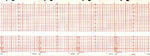 Graphic Controls Medical Chart Recording Papers 7G30748696 - 1.0 Each