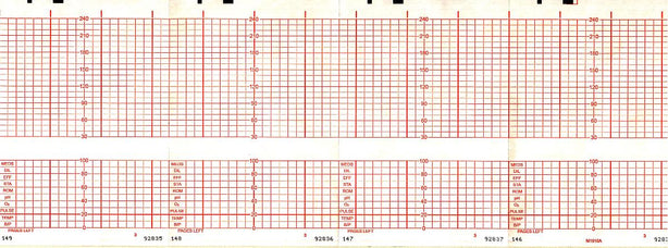 Graphic Controls Medical Chart Recording Papers 7G30748696 - 1.0 Each