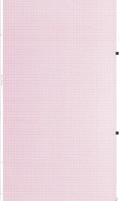Graphic Controls Medical Chart Recording Papers 30999174 - 10.0 Pad