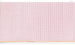 Graphic Controls Medical Chart Recording Papers 7G32030927 - 18.0 Roll