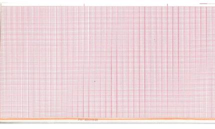 Graphic Controls Medical Chart Recording Papers 7G32030927 - 18.0 Roll