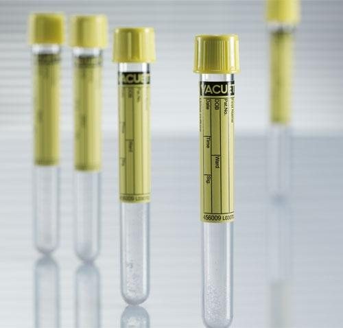 GREINER BIO ONE VACUETTE Z Urine No Additive Urinalysis Tubes 456007 1200 Each - MDL-GRI456007