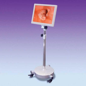 GYNEX Gynex Colposcope Sets 450MS 1 Each-MDL-GYN450MS