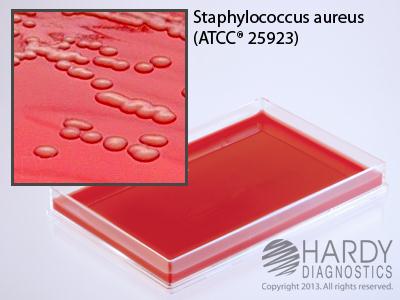 Hardy Diagnostics Blood Agar (TSA) with 5% Sheep Blood - HADA127