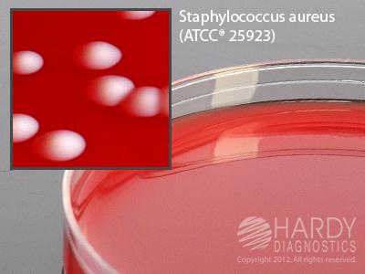 Hardy Diagnostics A16BX Columbia Blood Agar, 5% Sheep, 15 x 100 mm Plate - MDL-HADA16BX - 100 Each
