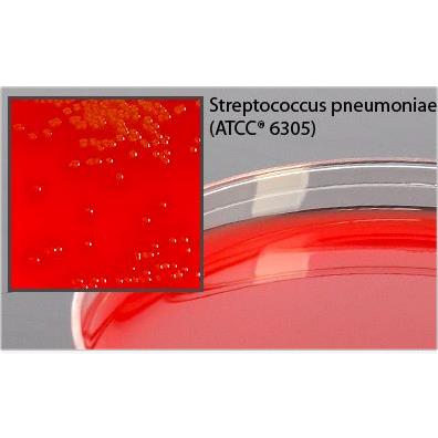 Hardy Diagnostics BHI Agar with 5% Sheep Blood, 15 x 100mm - A20 - 10 Each