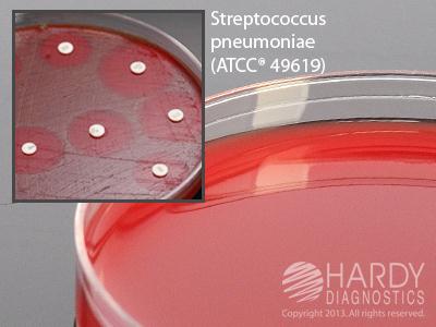HARDY DIAGNOSTICS Mueller Hinton Agar with Blood A59 10 Each - MDL-HADA59