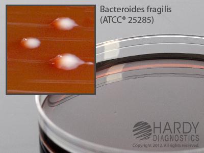 Hardy Diagnostics Hardy Diagnostics LKV Agar A60 - 10.0 Each - MDL-HADA60