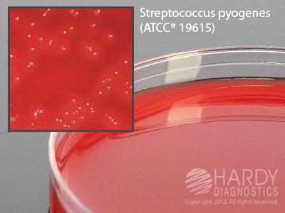 HARDY DIAGNOSTICS Selective Strep Agar A70 10 Each-MDL-HADA70