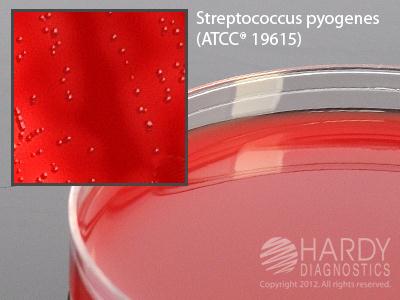 Hardy Diagnostics Selective Beta Strep Agar A72 - 10.0 Each - MDL-HADA72