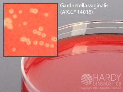 Hardy Diagnostics Gardnerella Vaginalis V. Agar A80 - 10.0 Each