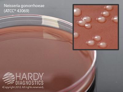 HARDY DIAGNOSTICS Hardy Diagnostics Chocolate Agar E14 10 Each - MDL-HADE14