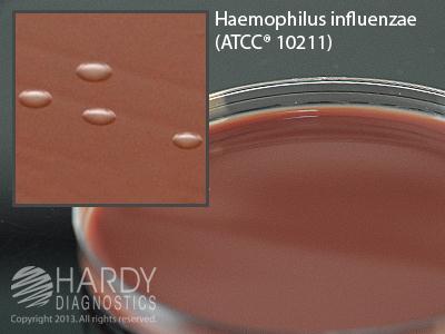 Hardy Diagnostics Mueller Hinton Agr with Choc E20 - 10.0 Each - MDL-HADE20