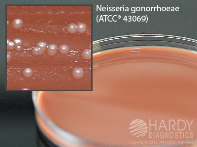 Hardy Diagnostics Thayer Martin Modified Agar E30 - 10.0 Each