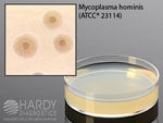 HARDY DIAGNOSTICS A8 Agar For Mycoplasma G02 10 Each - MDL-HADG02