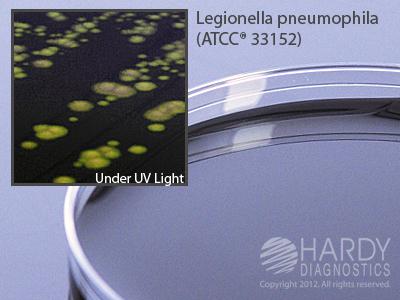 Hardy Diagnostics BCYE Selective Agar With Cav Antibiotics (Buffered Charcoalyeast Extract), For Legionella, 15 x 100 mm Plate - G08 - 10 Each