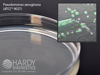 Hardy Diagnostics Cetrimide Select Agar for Pseudomonas G18 - 10.0 Each