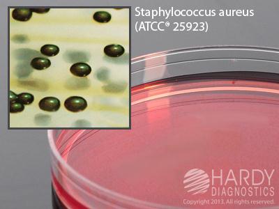 Hardy Diagnostics G193 Vogel And Johnson Agar, 15 x 100 mm Plate - MDL-HADG193 - 10 Each