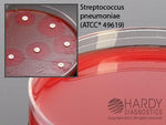 Hardy Diagnostics H21 Mueller Hinton Agar With Blood, Large 15 x 150 mm Plate - MDL-HADH21 - 10 Each