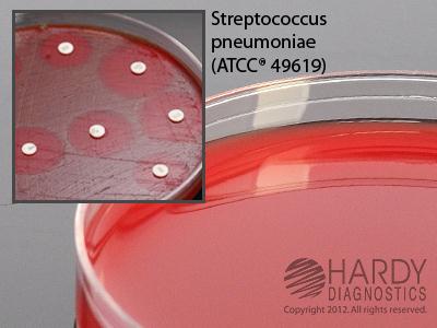 Hardy Diagnostics H21 Mueller Hinton Agar With Blood, Large 15 x 150 mm Plate - MDL-HADH21 - 10 Each