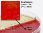 Hardy Diagnostics Blood Agar / HardyCHROM UTI - HADJ119