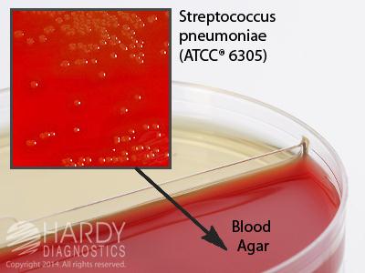Hardy Diagnostics Blood Agar / HardyCHROM UTI - HADJ119