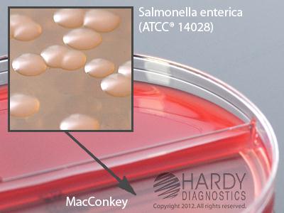 HARDY DIAGNOSTICS Blood Agar/MacConkey Biplate J32 10 Each - MDL-HADJ32