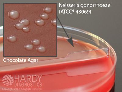 HARDY DIAGNOSTICS Blood Agar 5%/Chocolate J42 10 Each - MDL-HADJ42