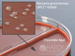 Chocolate/Modified Thayer Martin Biplate - J72 - 10 Each - MDL-HADJ72