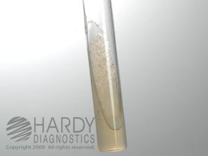 HARDY DIAGNOSTICS Middlebrook 7H11/7H11 Selective Biplate J75 10 Each - MDL-HADJ75