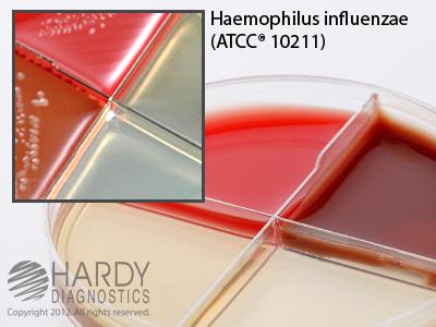 Hardy Diagnostics Haemophilus ID QuadPlate J82 - 10.0 Each - MDL-HADJ82