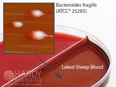 Brucella Agar with Hemin and Vitamin K /LKV Agar - J87 - 10 Each - MDL-HADJ87