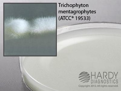 Hardy Diagnostics Potato Flake Selective Agar W159 - 10.0 Each