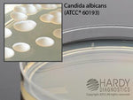 Hardy Diagnostics Emmon's Sabdex Agar W20 - 10.0 Each