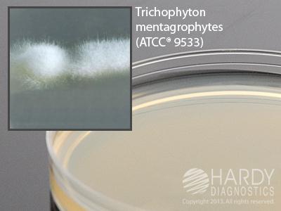 Hardy Diagnostics Inhibitory Mold Agar W25 - 10.0 Each