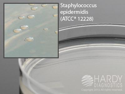 Nutrient Agar Plate - W51 - 10 Each - MDL-HADW51