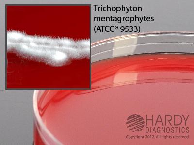 Hardy Diagnostics W65 BHI (Brain Heart Infusion) Agar With Blood, Chloramphenicoland Gentamicin, Deep Fill, 15 x 100 mm Plate - MDL-HADW65 - 10 Each