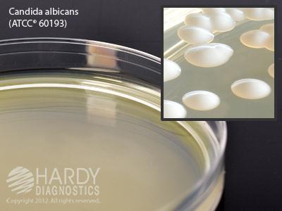 Hardy Diagnostics Sabdex Agars W70 - 10.0 Each