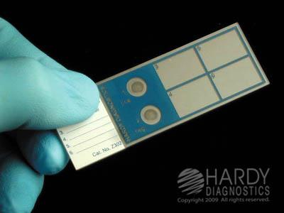 Hardy Diagnostics Q-Slide Z302 - 5.0 Each