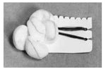 TELEFLEX MEDICAL Sterile Tonsil Sponges 200340 5 Each - MDL-HUD200340Z