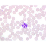 Stain Packs for Definitive DCM Slide Stainer - DCM-VDS-016 - 1 Each - MDL-HVODCMVDS016