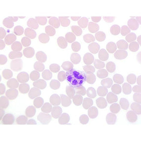 Stain Packs for Definitive DCM Slide Stainer - DCM-VDS-016 - 1 Each - MDL-HVODCMVDS016