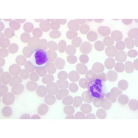 Stain Packs for Definitive DCM Slide Stainer - DCM-VDSM-016 - 1 Each - MDL-HVODCMVDSM016