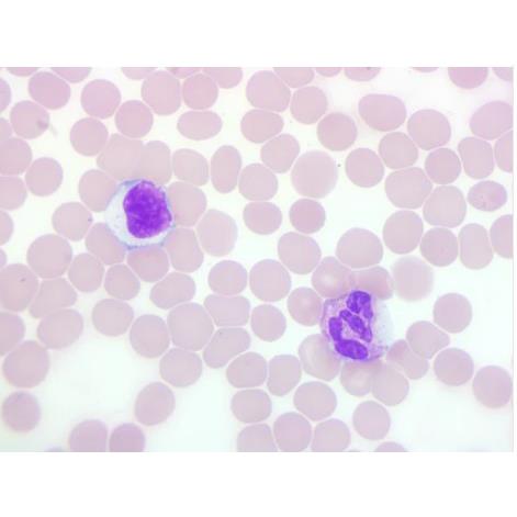 Stain Packs for Definitive DCM Slide Stainer - DCM-VMY-016 - 1 Each - MDL-HVODCMVMY016
