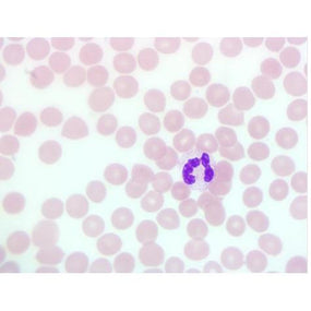 Stain Packs for Definitive DCM Slide Stainer - DCM-VWG-016 - 1 Each - MDL-HVODCMVWG016