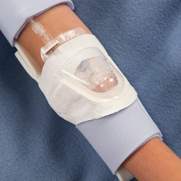 I. V. House Splints: TLC Foam Padded Elbow Splint with 2 Straps and Hook-and-Loop Closure, Size XL 959XL-ULTRA/24 - 24.0 Each
