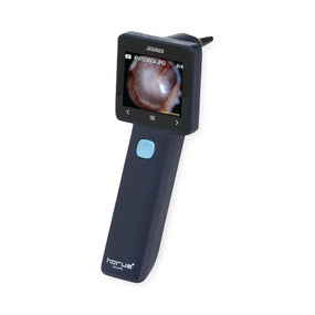 JEDMED Horus + HD Video Otoscopes 39-7405 1 Each - MDL-JMD397405